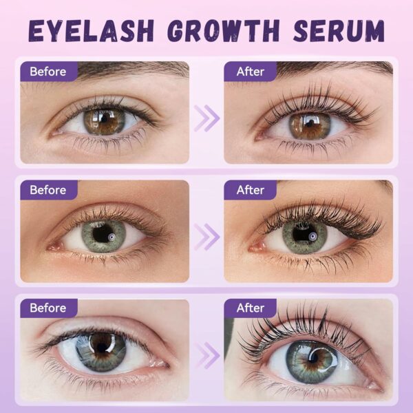 Eyelash Serum, Premium Eyelash Serum for Longer, - Image 7